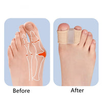 Dubbel tåseparerare för hallux valgus – mjukt silikon, 2-pack