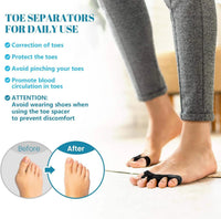 Tåseparerare i silikon mot hallux valgus (2-pack)